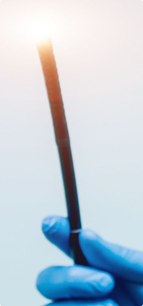 Imagen de colonoscopía